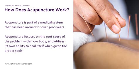 Uncovering the Truth: Does Acupuncture Work for Pain Relief and Wellness?