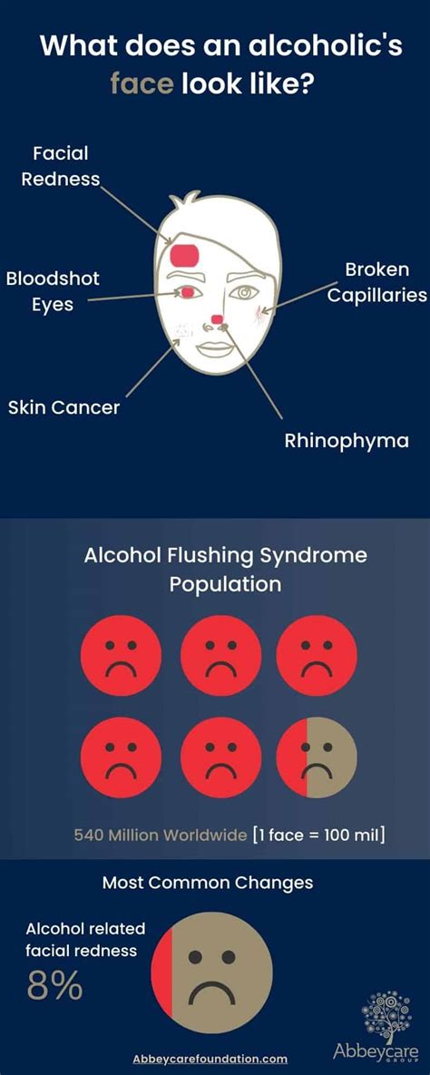 Does Alcohol Cause A Fat Face