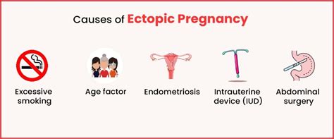 Does Alcohol Cause Ectopic Pregnancy