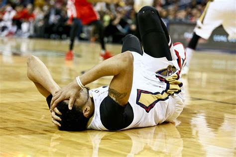does anthony davis have a concussion