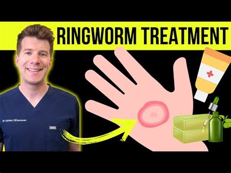 Does Antifungal Kill Ringworm