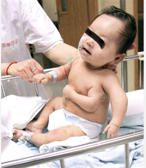 Does Anyone Have Four Arms