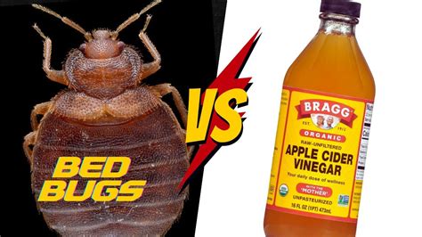Does Apple Cider Vinegar Kill Bed Bug Bites