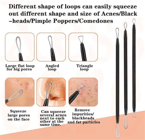 Does Blackhead Remover Tool Work