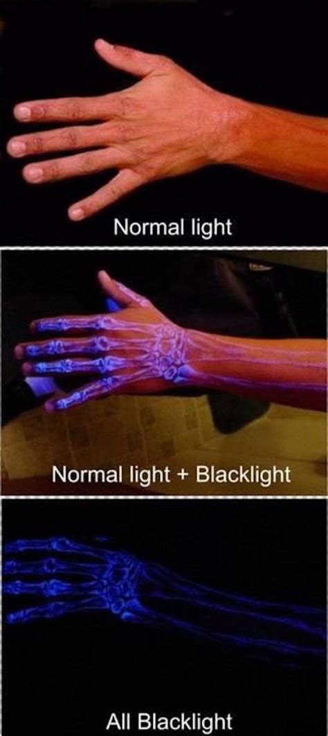 Does Bone Glow Under Black Light