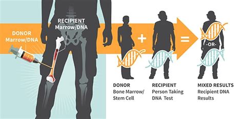 Does Bone Marrow Transplant Affect Dna Test