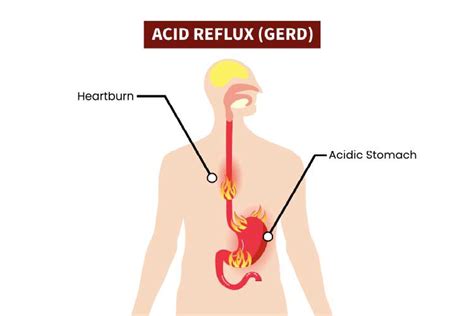 Does Burping Release Gas