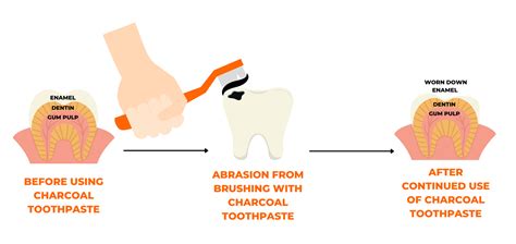 Charcoal toothpaste not good for your teeth's enamel, dentist warns