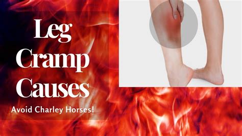 does charley horse cause cramping