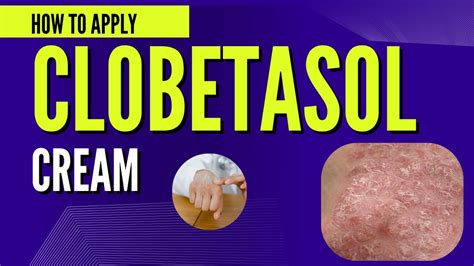 Does Clobetasol Stop Itching