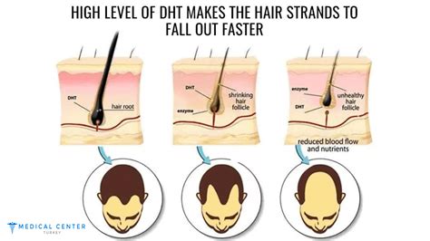 Does Coffee Block Dht