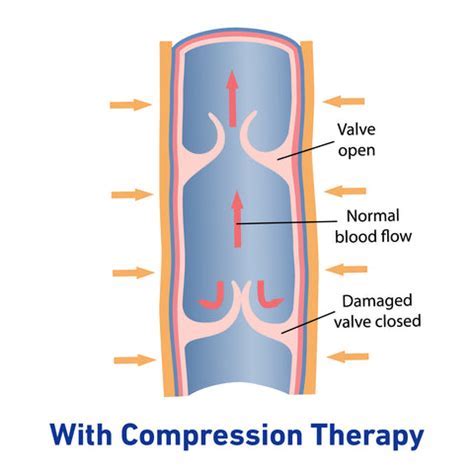Does Compression Actually Work