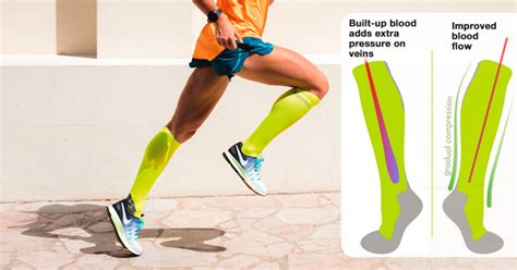 Does Compression Socks Help With Running