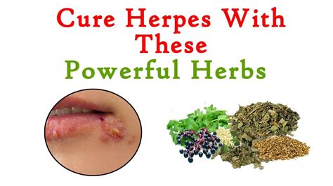 Does Cooking Kill Herpes Virus