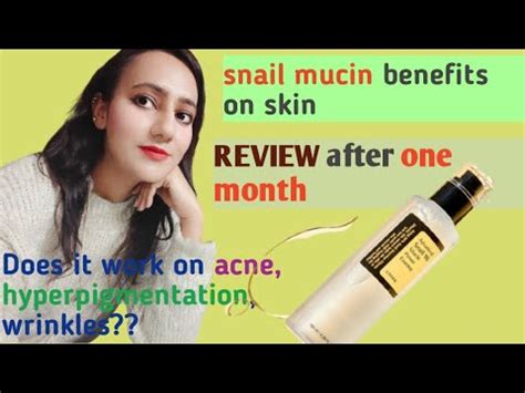 does cosrx snail mucin work for hyperpigmentation