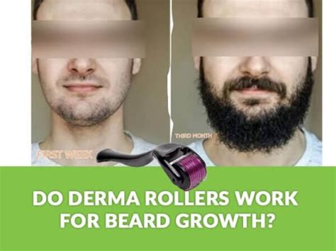 Does Derma Roller Work For Beard Growth Reddit