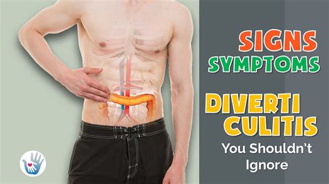 does diverticulitis cause indigestion