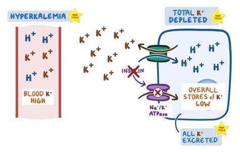 Does Dka Cause Hyperkalemia