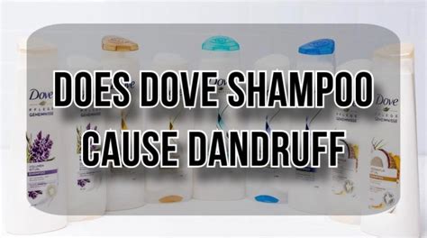 Does Dove Shampoo Cause Dandruff