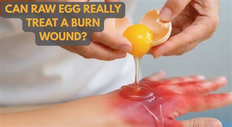 Does Egg Burn Fat