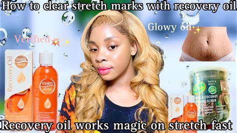 Does Engine Oil Clear Stretch Marks