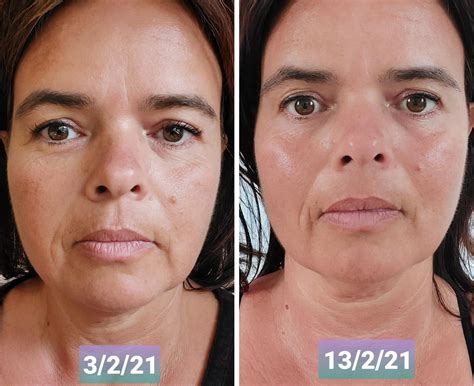 does face exercise work before and after