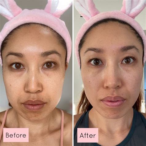does face exercises work
