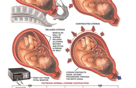 Does Fetal Movement Cause Contractions