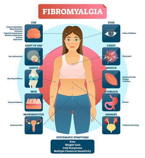 does fibromyalgia affect life expectancy
