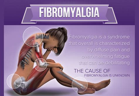 does fibromyalgia cause pain