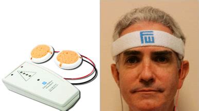 does fisher wallace cranial stimulator work