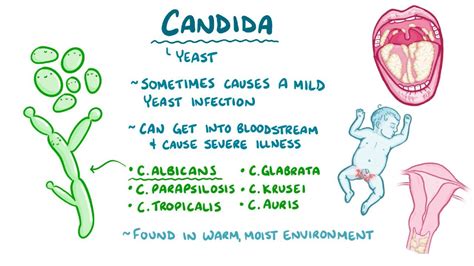 Does Flour Feed Candida