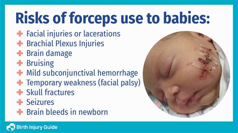 Does Forceps Hurt Baby