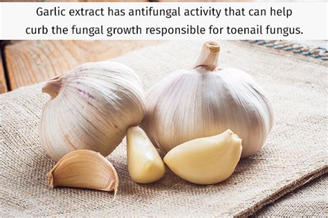 Does Garlic Help Toenail Fungus