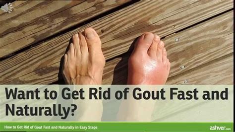 does gout get better with exercise