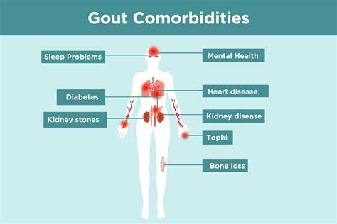 does gout medicine hurt your kidneys