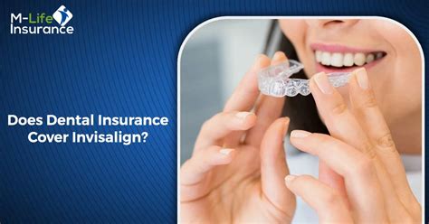 does guardian dental insurance cover invisalign
