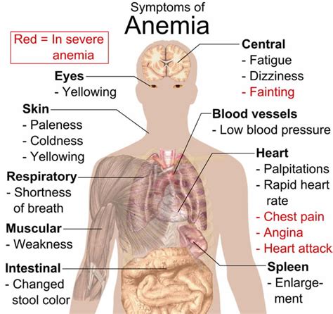 Heatstroke Risks For People With Anemia And How To Stay Safe