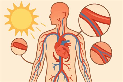 Does Heat Affect Hypertension