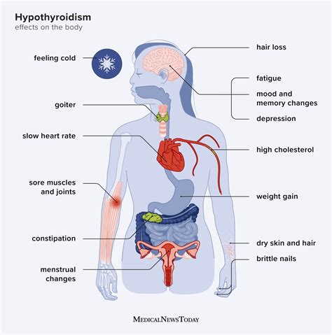 Does Heat Affect Underactive Thyroid Symptoms