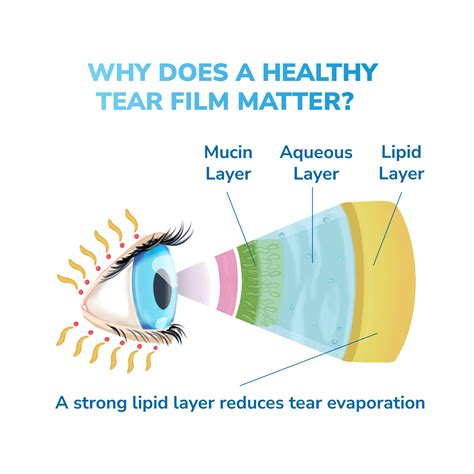 Does Heat Help A Black Eye