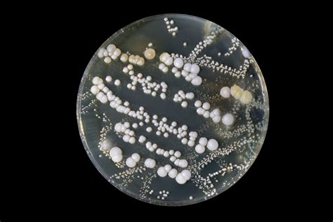 does homegenius flooring grow bacteria