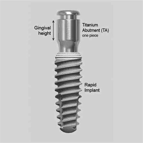 does hot weather affect titanium implants