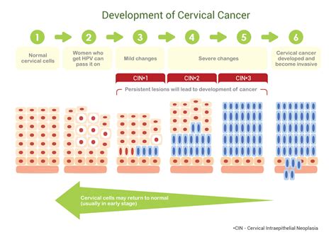 does hpv lead to cancer