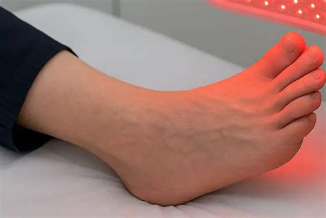 Does Infrared Light Help Neuropathy