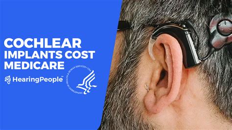 Does Medicare Cover Cochlear Implants?