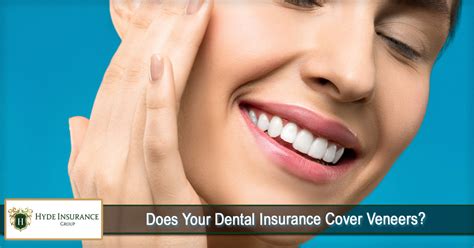 How to Maximize Insurance Coverage for Veneers: A Comprehensive Guide