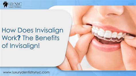 Does Invisalign Work Permanently