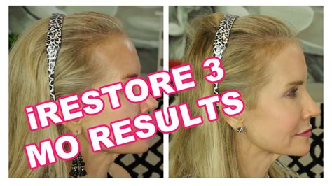 does irestore cause hair loss