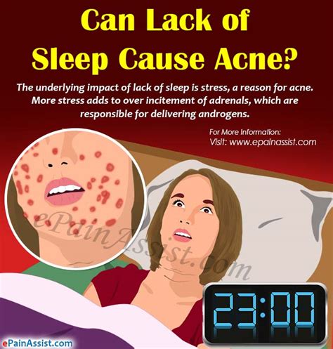 Does Lack of Sleep Cause Acne?
